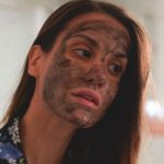 Blackhead Acne Treatment - Ways To Get Rid of Blackheads At Home