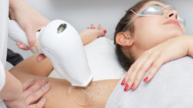 All About Laser Hair Removal