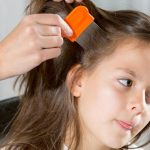 Useful Curing Methods For Lice And Nits
