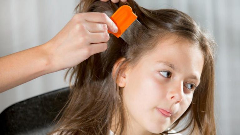 Useful Curing Methods For Lice And Nits