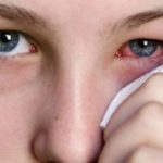 Pink Eye Symptoms
